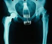 buttpage (9k image)